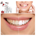 100% Natural Teeth Whitening Charcoal Powder - Beautift